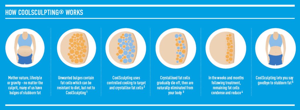 How CoolSculpting fat freezing works